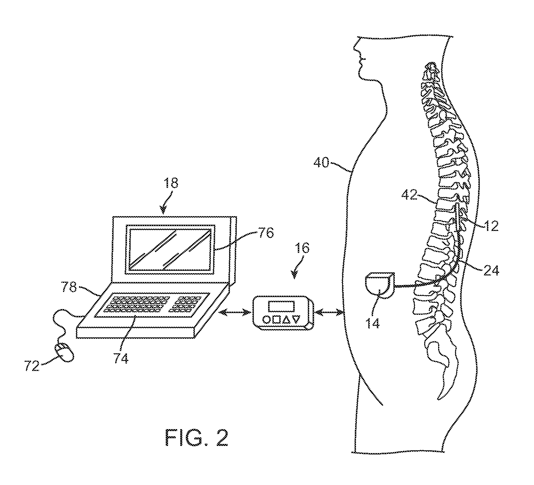 Tissue stimulation system and method with anatomy and physiology driven programming