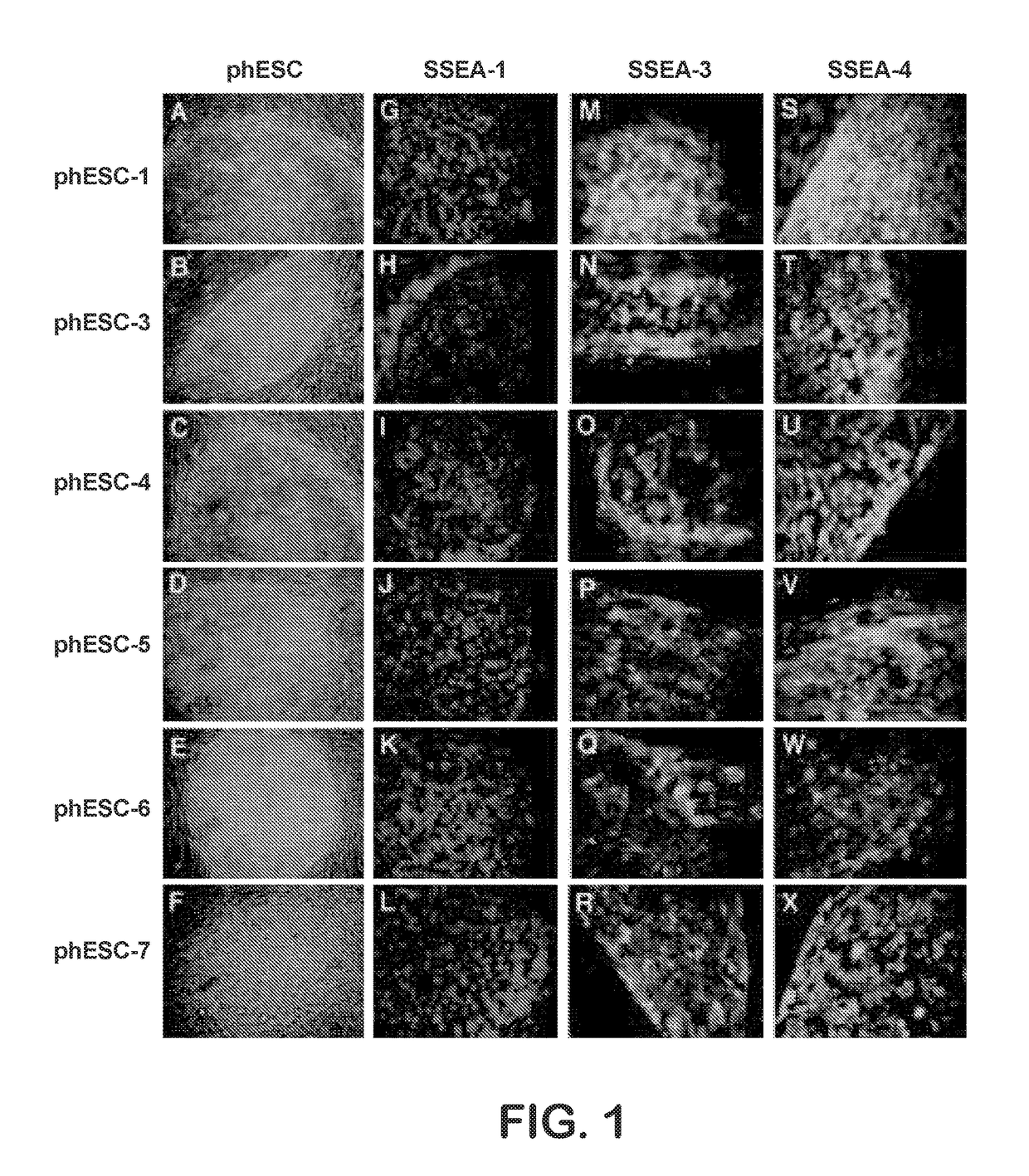 Patient-specific stem cell lines derived from human parthenogenetic blastocysts