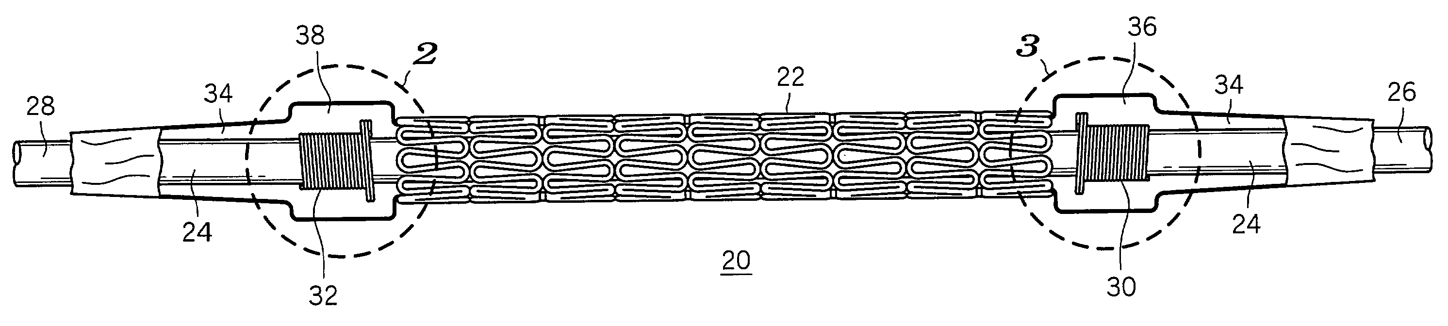 Stent delivery and retention apparatus