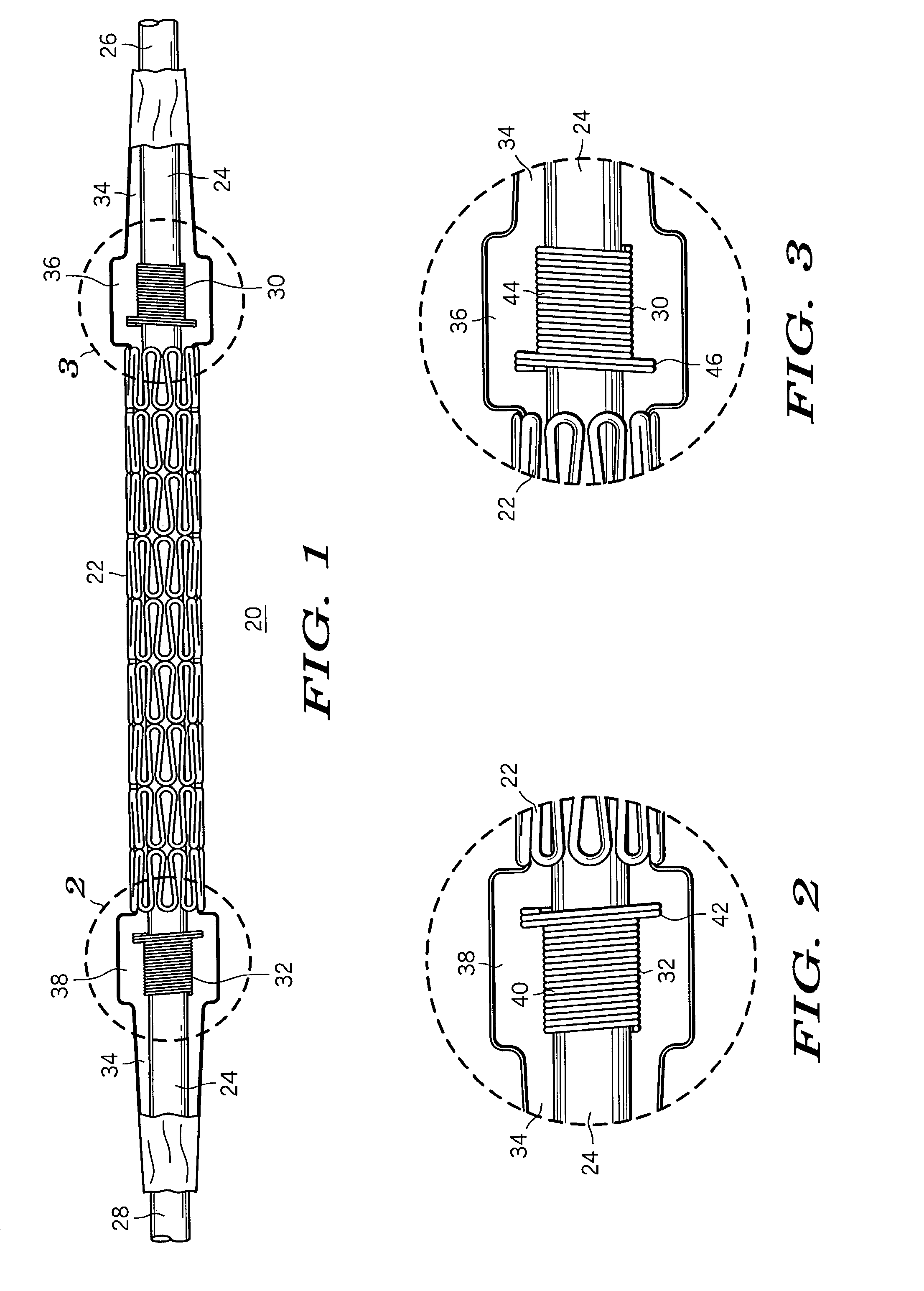 Stent delivery and retention apparatus