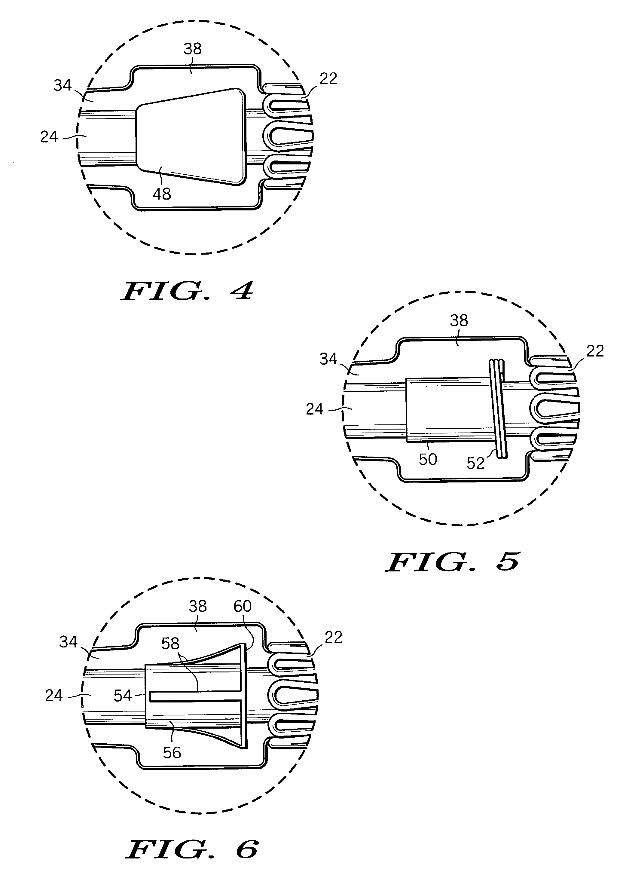 Stent delivery and retention apparatus