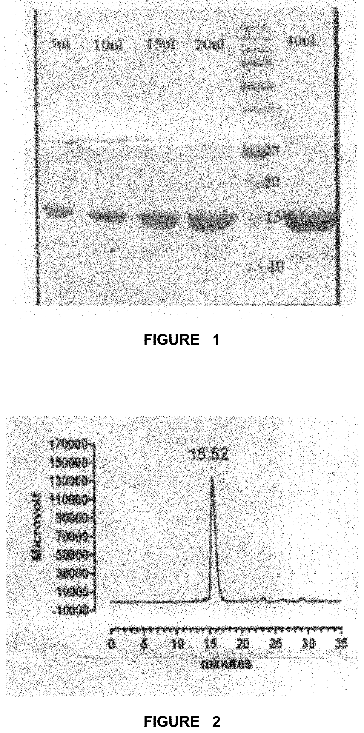 Method of treating overweight or obesity comprising administering a pleurotus ostreatus mushroom extract or a composition comprising a pleurotus ostretus mushroom extract