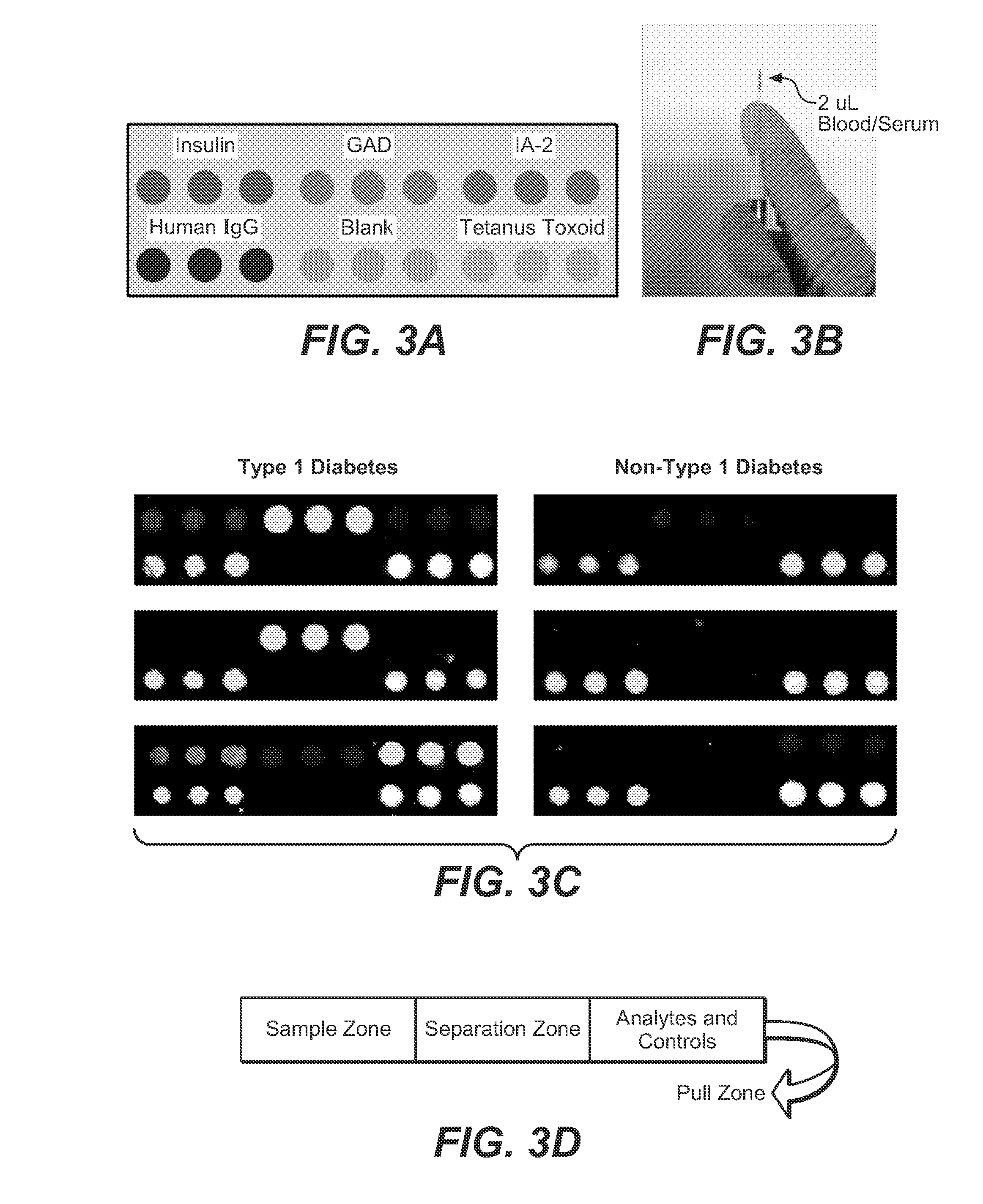 Plasmonic substrate for multiplex assessment of type 1 diabetes