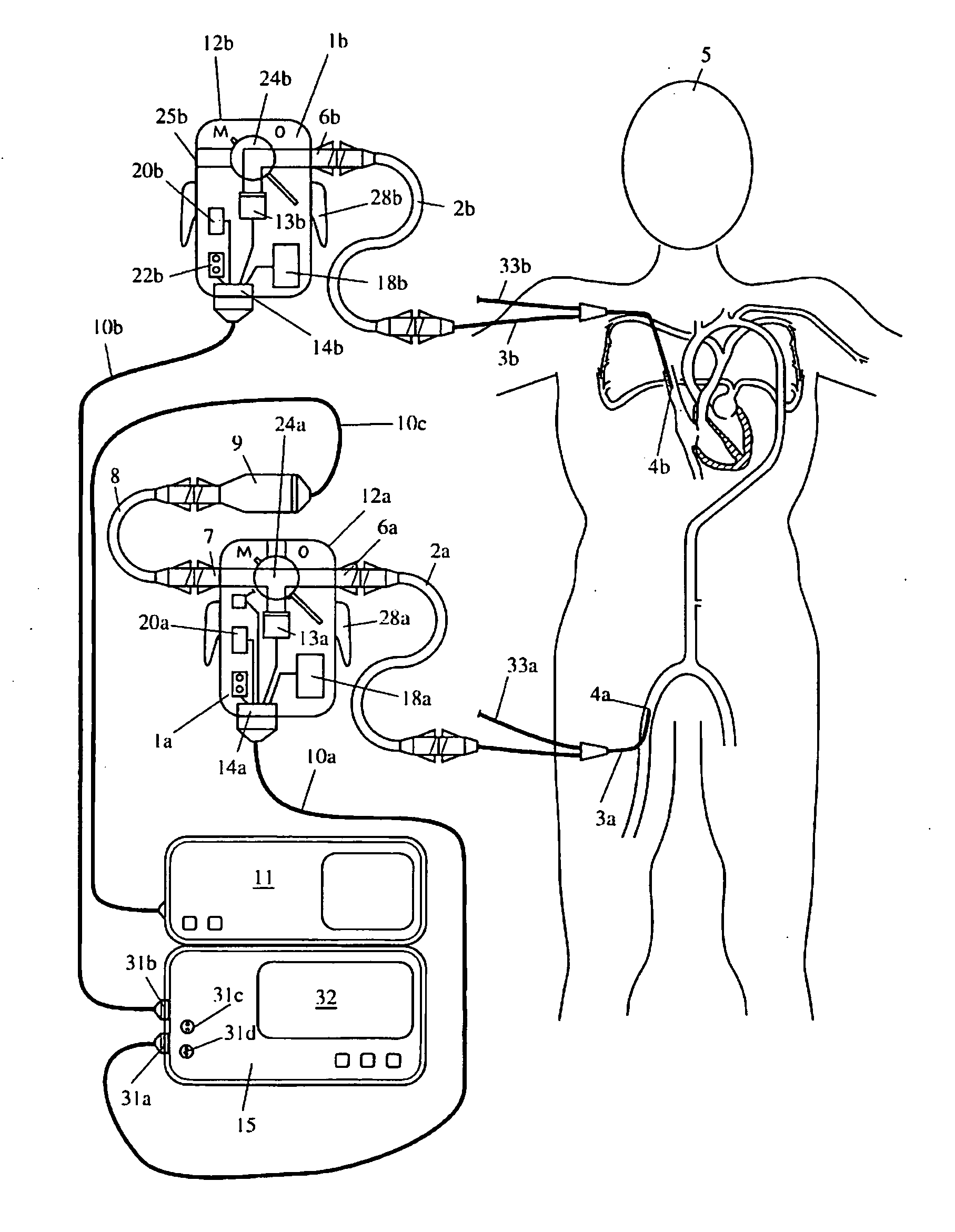 Portable sensor device and patient monitor