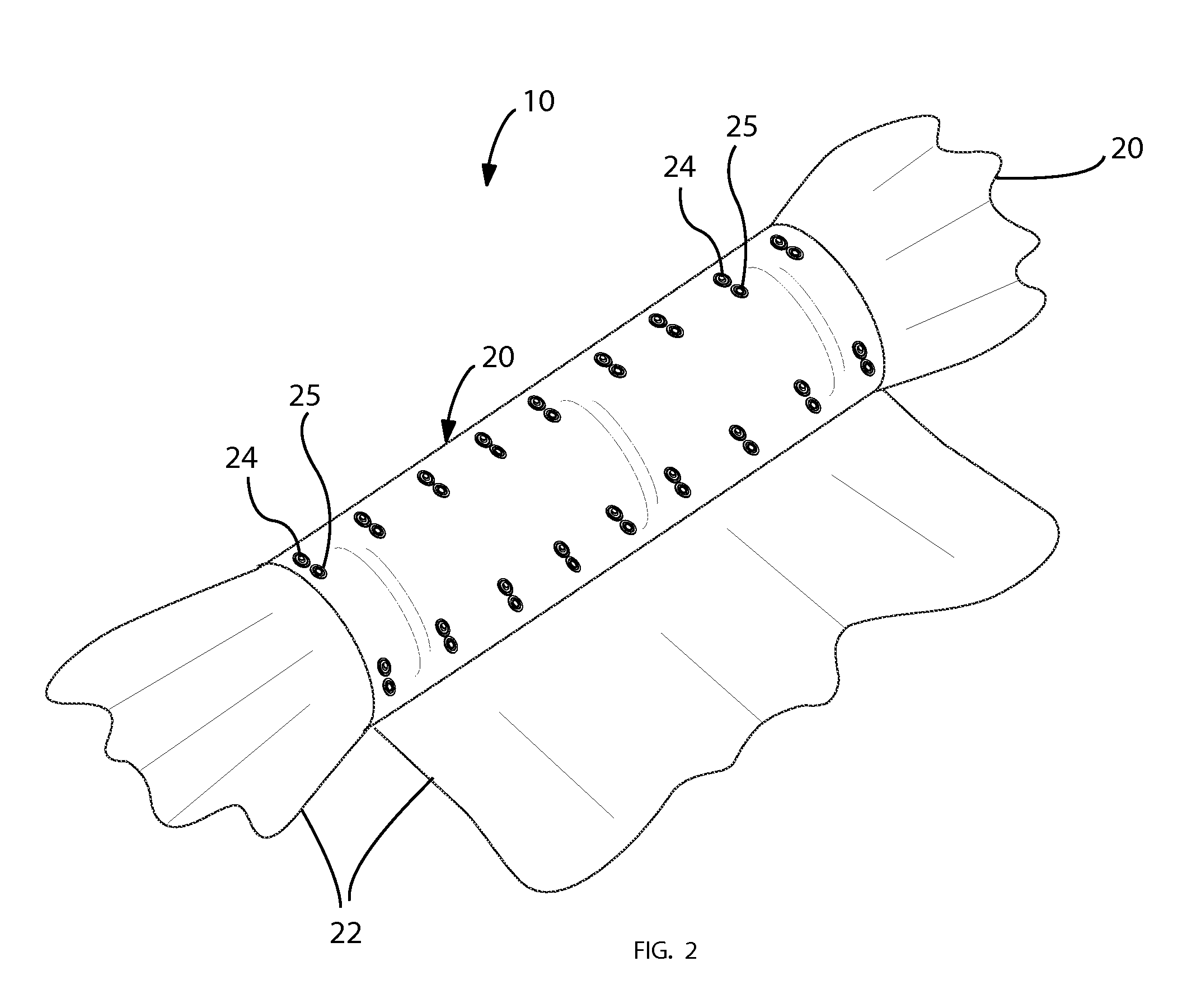Removable bed ruffle assembly and associated method
