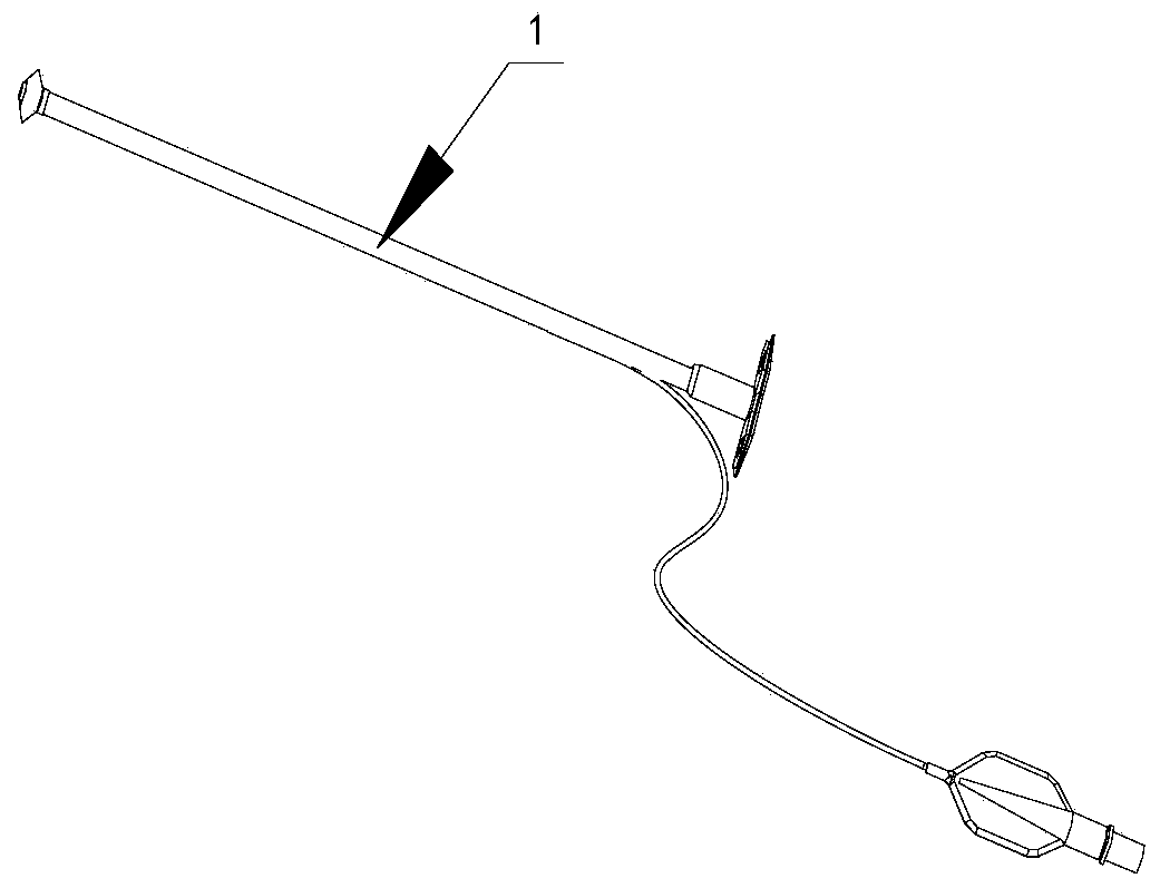 Removal device for removing ureteral stent