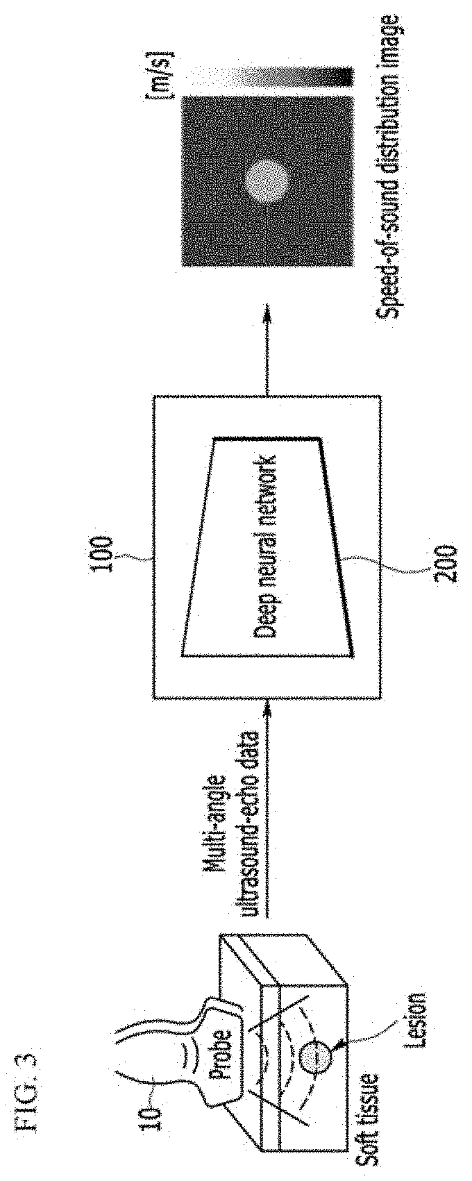 Method and apparatus for quantitative ultrasound imaging using single-ultrasound probe