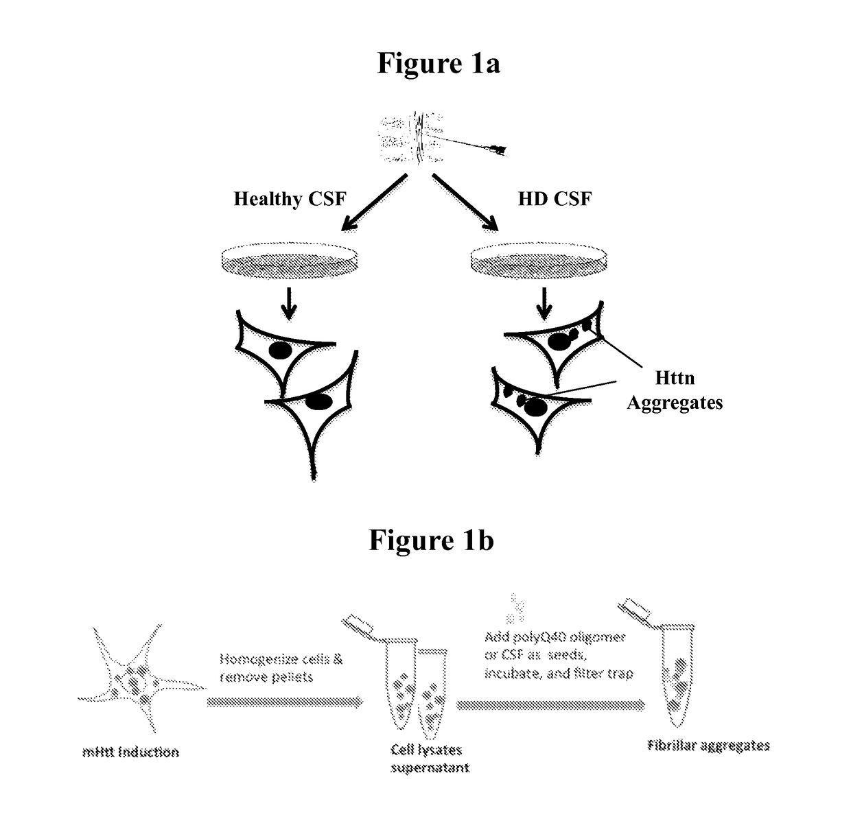 Diagnostic and monitoring system for Huntington's disease