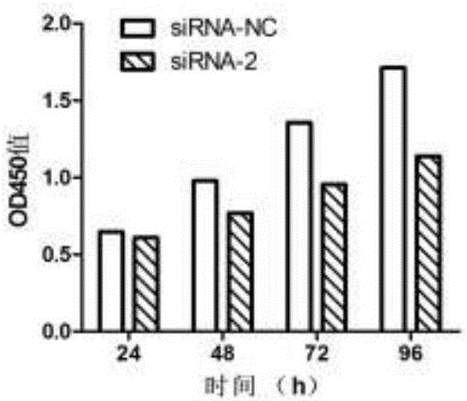 Application of DNAH14 gene in tumor diagnosis and treatment