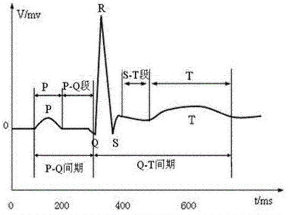 Double-layer morphological filter based electrocardiosignal preprocessing method