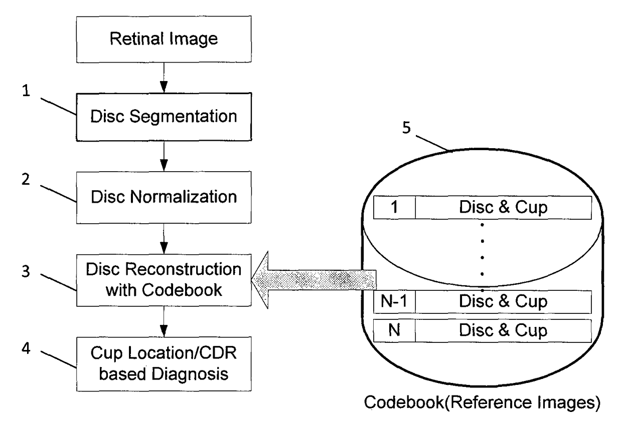 Cost-sensitive linear reconstruction based optic cup localization