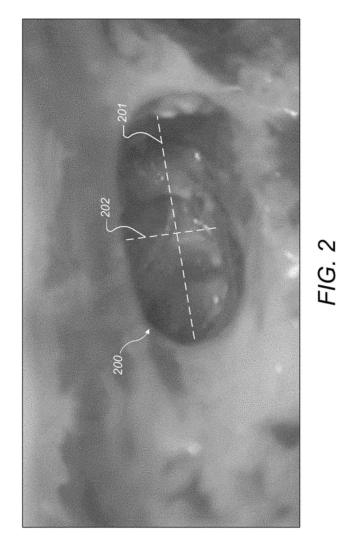 Electrode lead that avoids electrode array migration from the cochlea