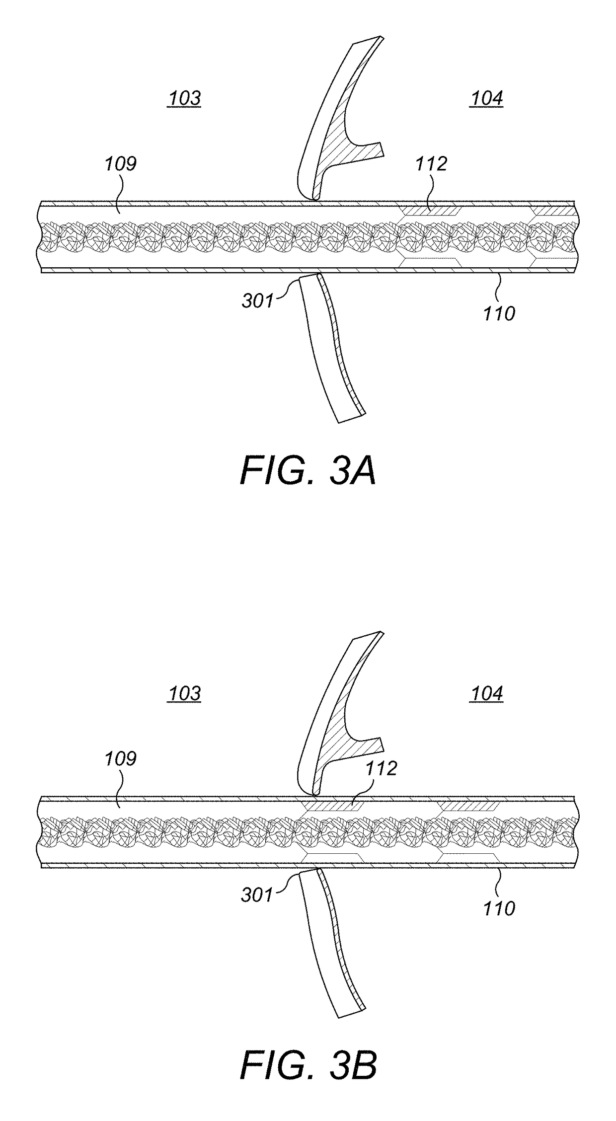 Electrode lead that avoids electrode array migration from the cochlea