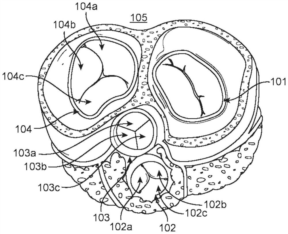 Methods and devices for heart valve repair