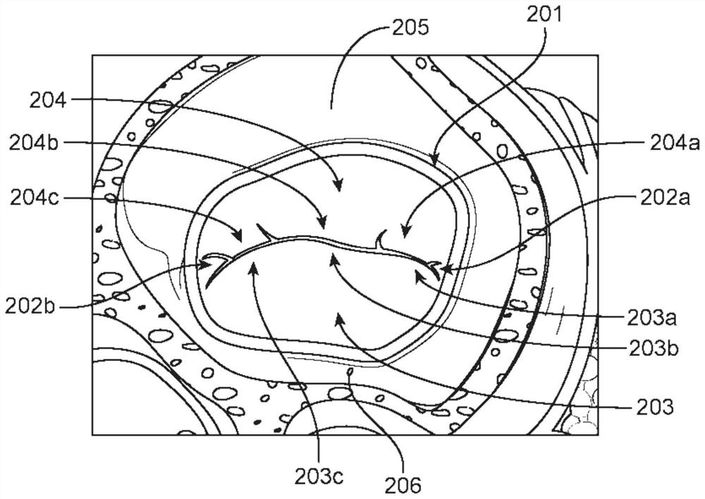 Methods and devices for heart valve repair