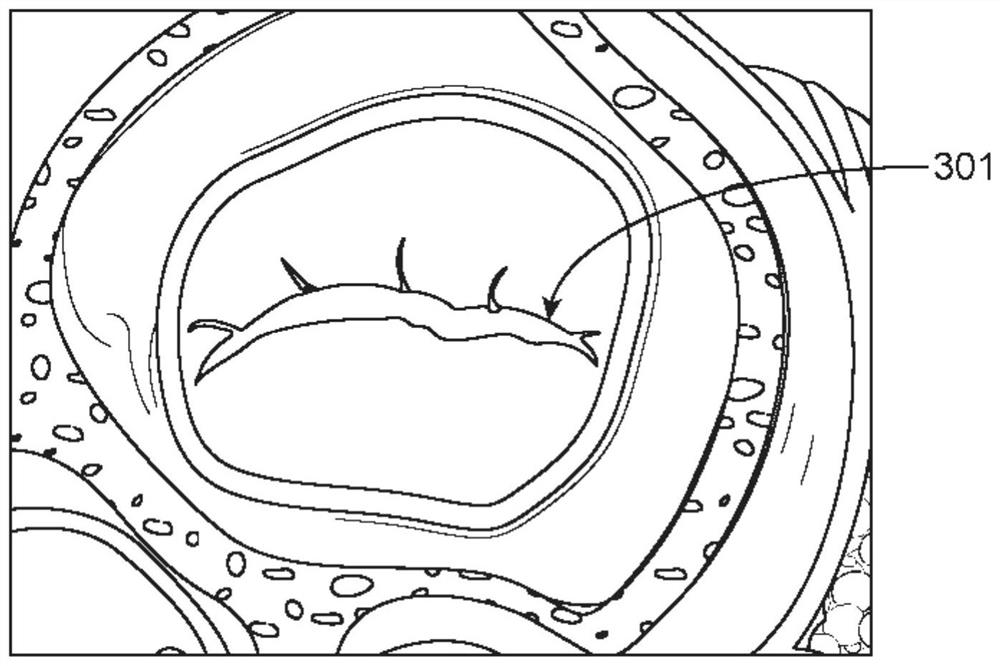 Methods and devices for heart valve repair