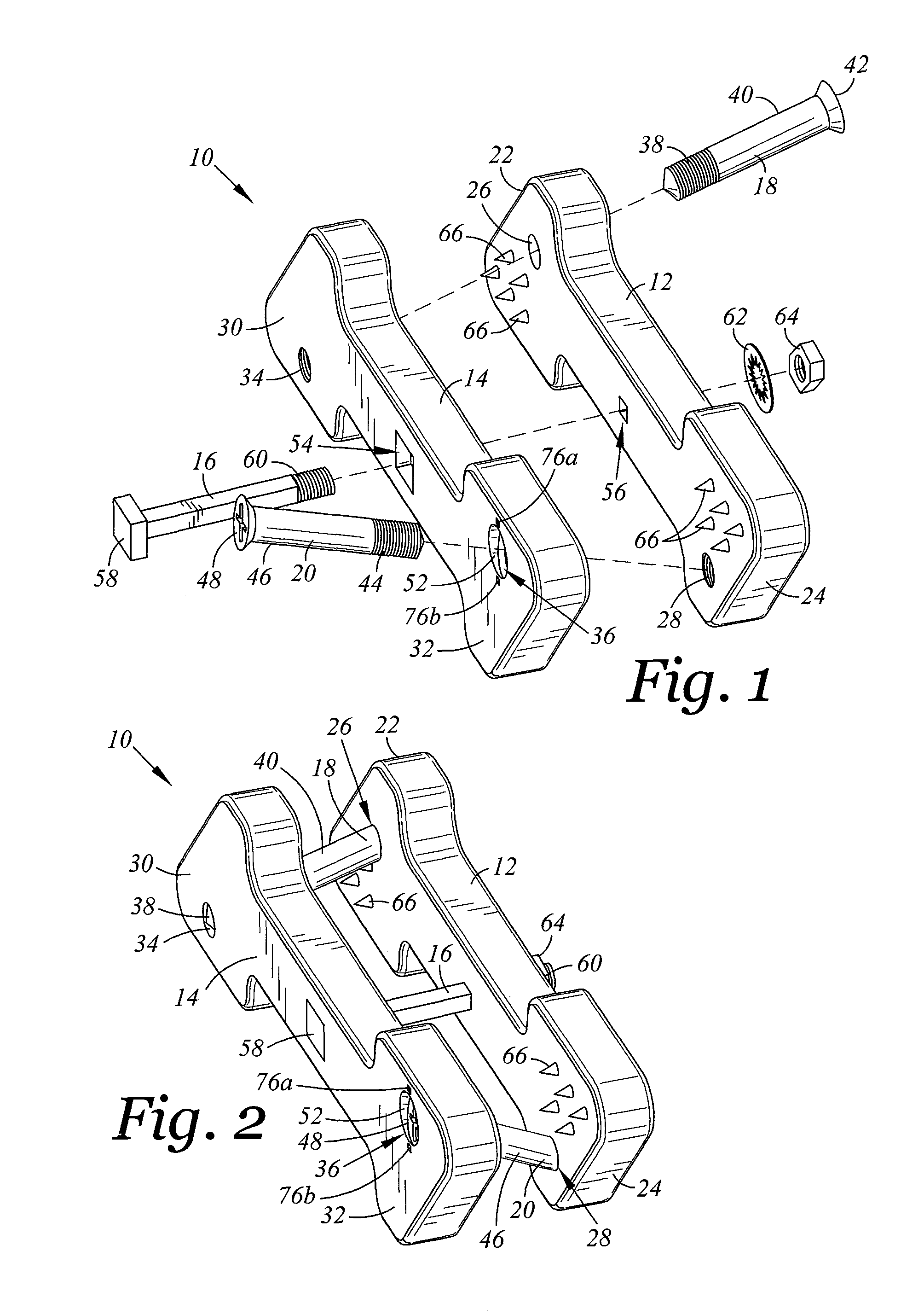Spinal implant device with fixation plates and lag screws and method of implanting