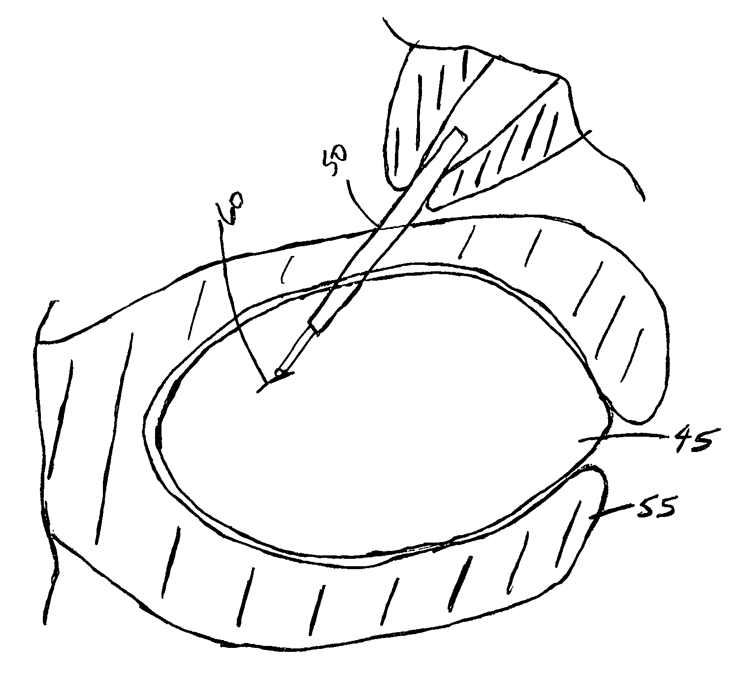 Apparatus for practicing ophthalmologic surgical techniques