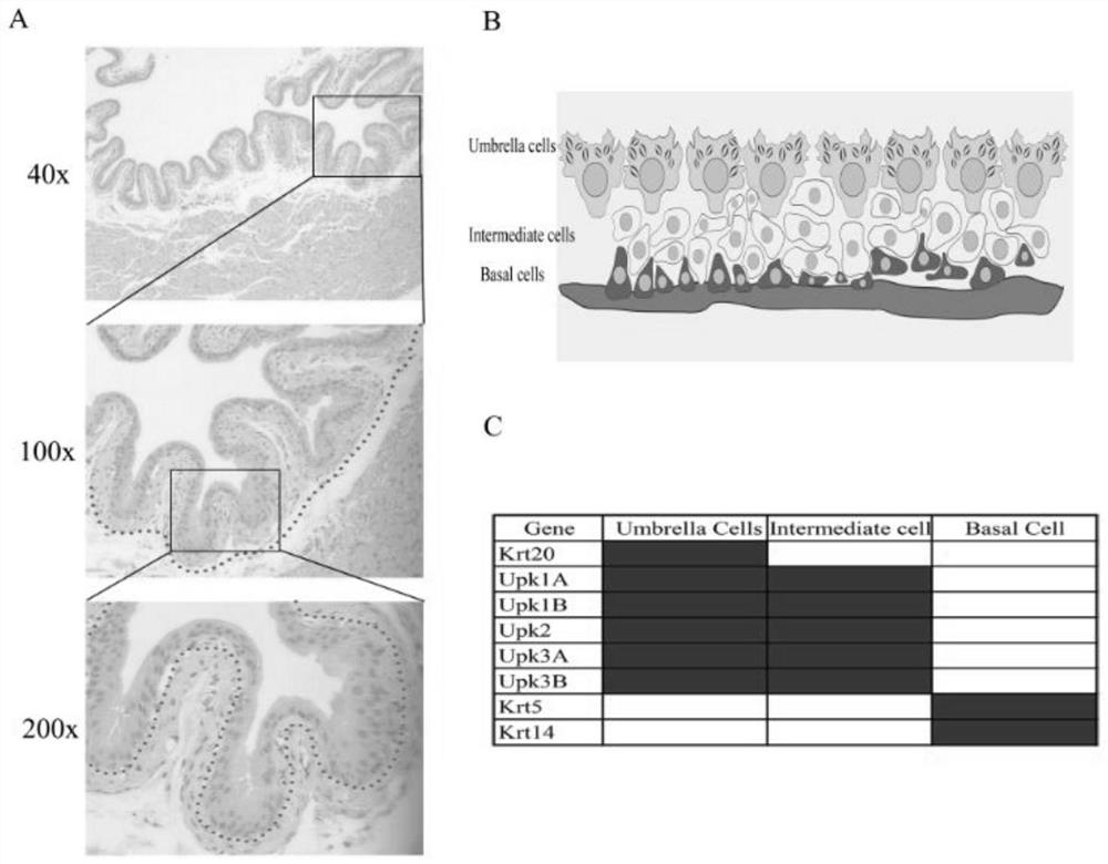 Preparation method and application of bladder urothelial single cell suspension for single cell sequencing