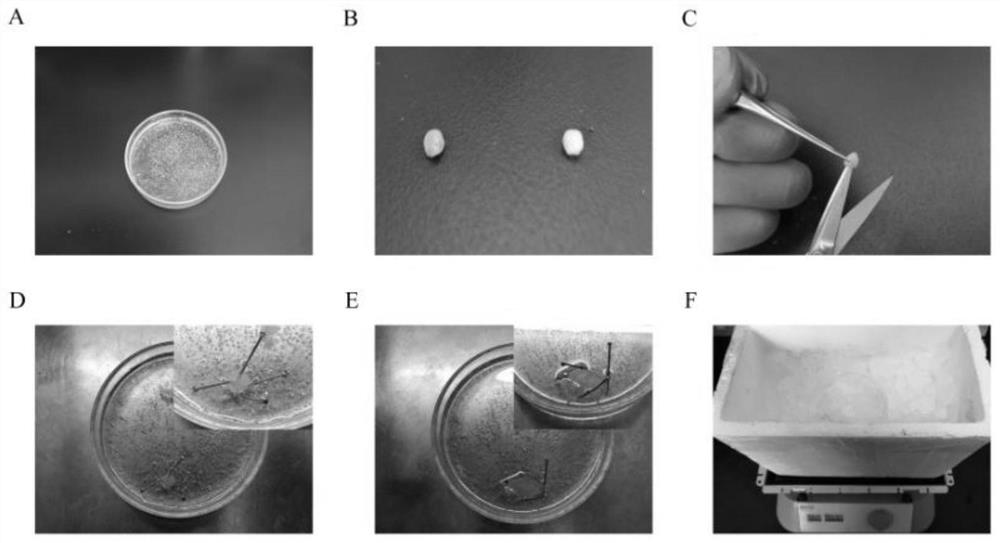 Preparation method and application of bladder urothelial single cell suspension for single cell sequencing