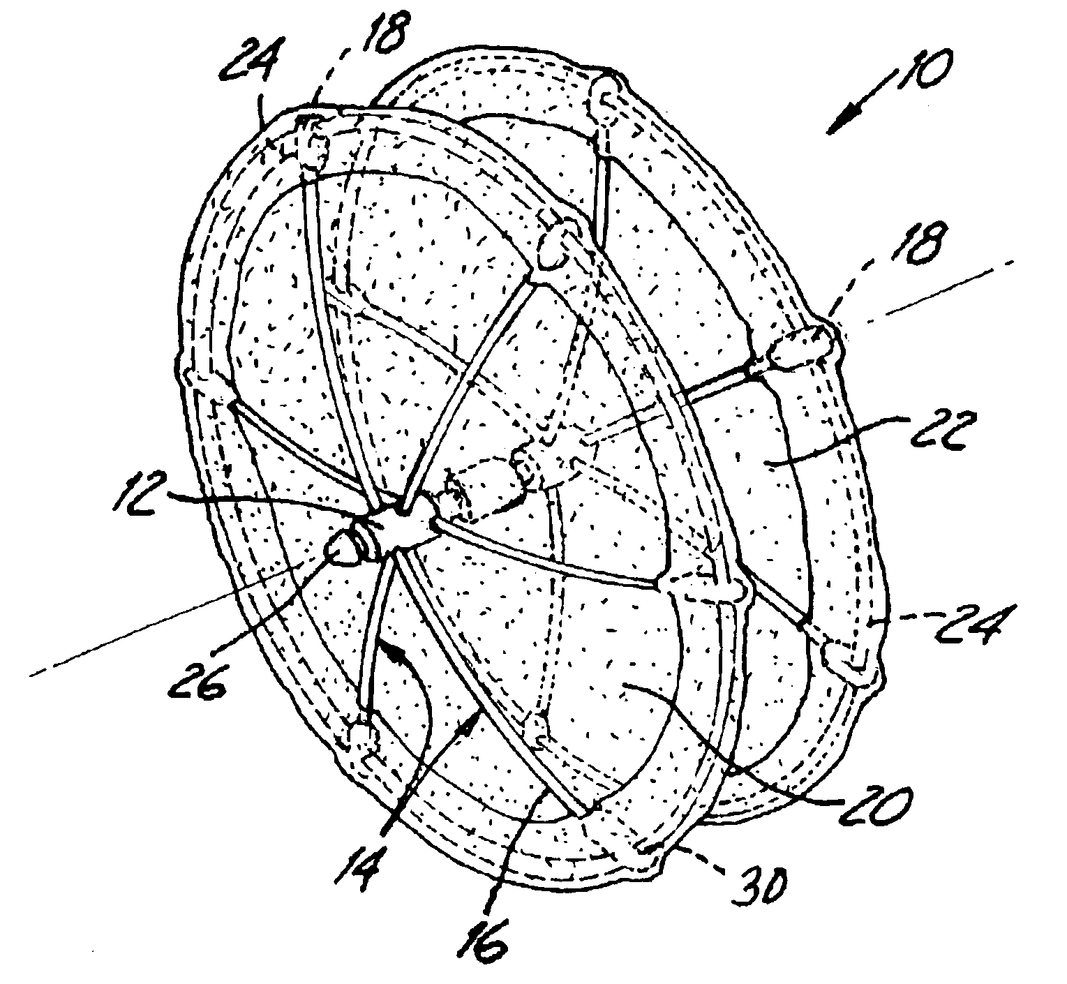Hoop design for occlusion device