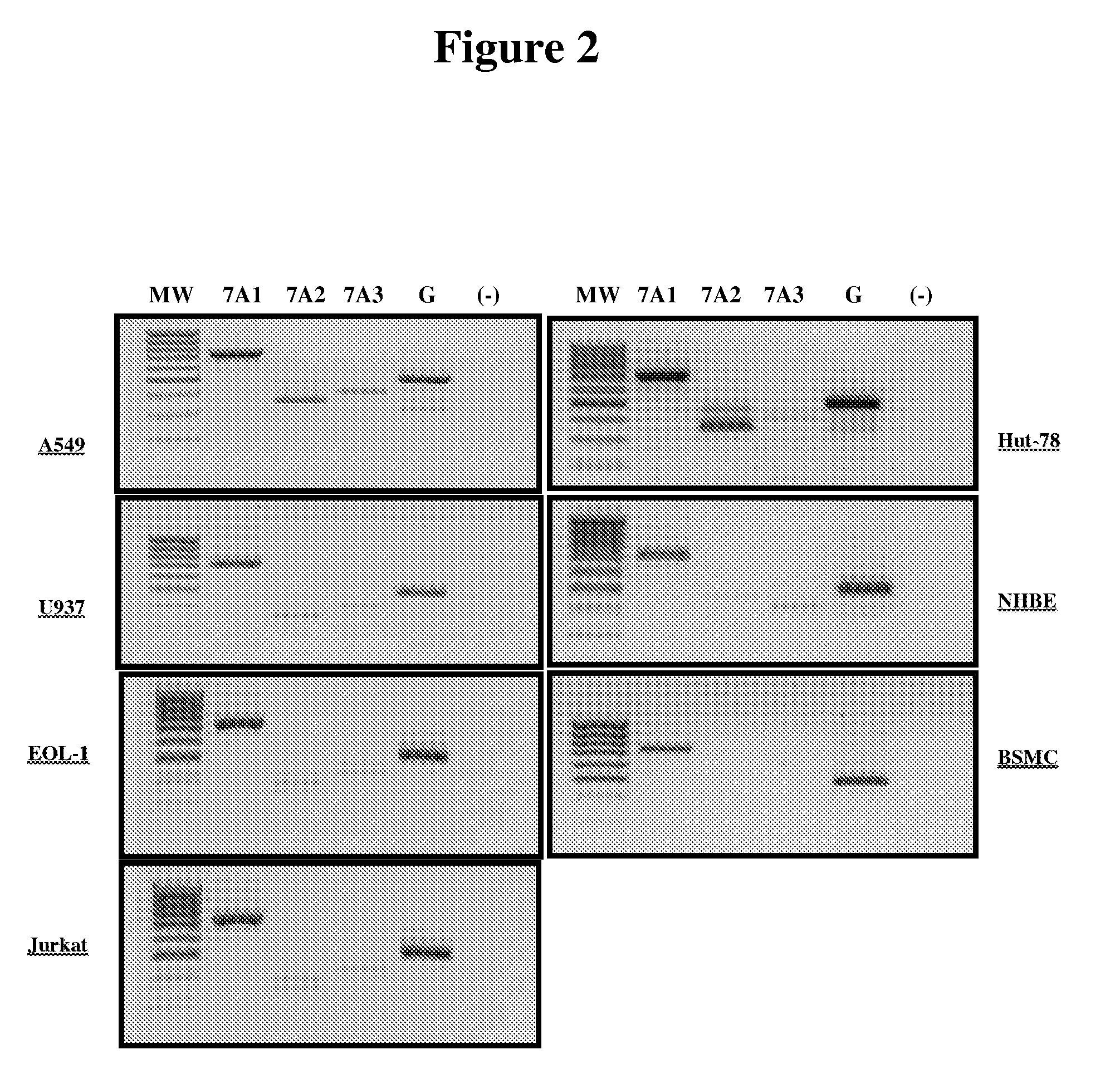 Oligonucleotide compositions and methods for treating disease including inflammatory conditions