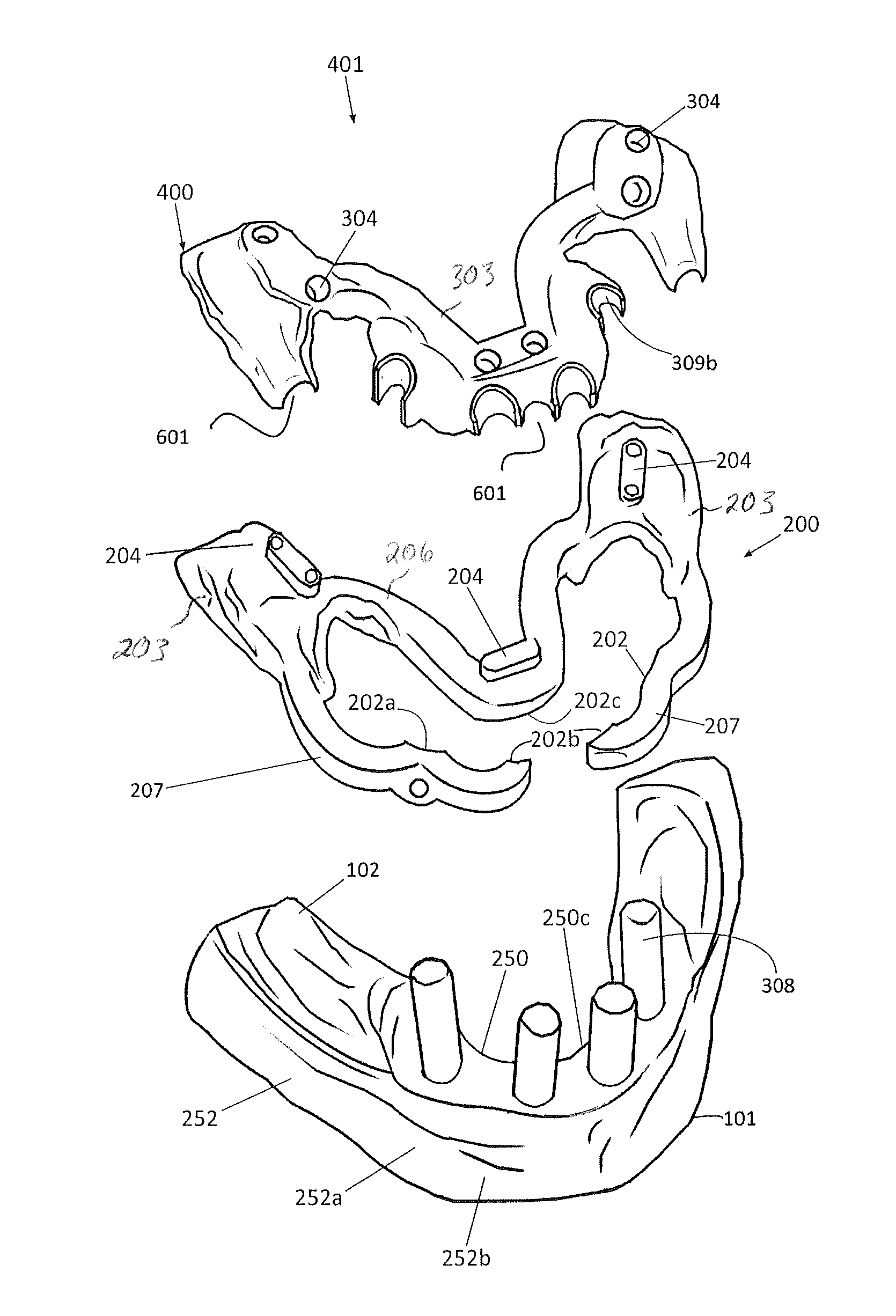 Edentulous surgical guide