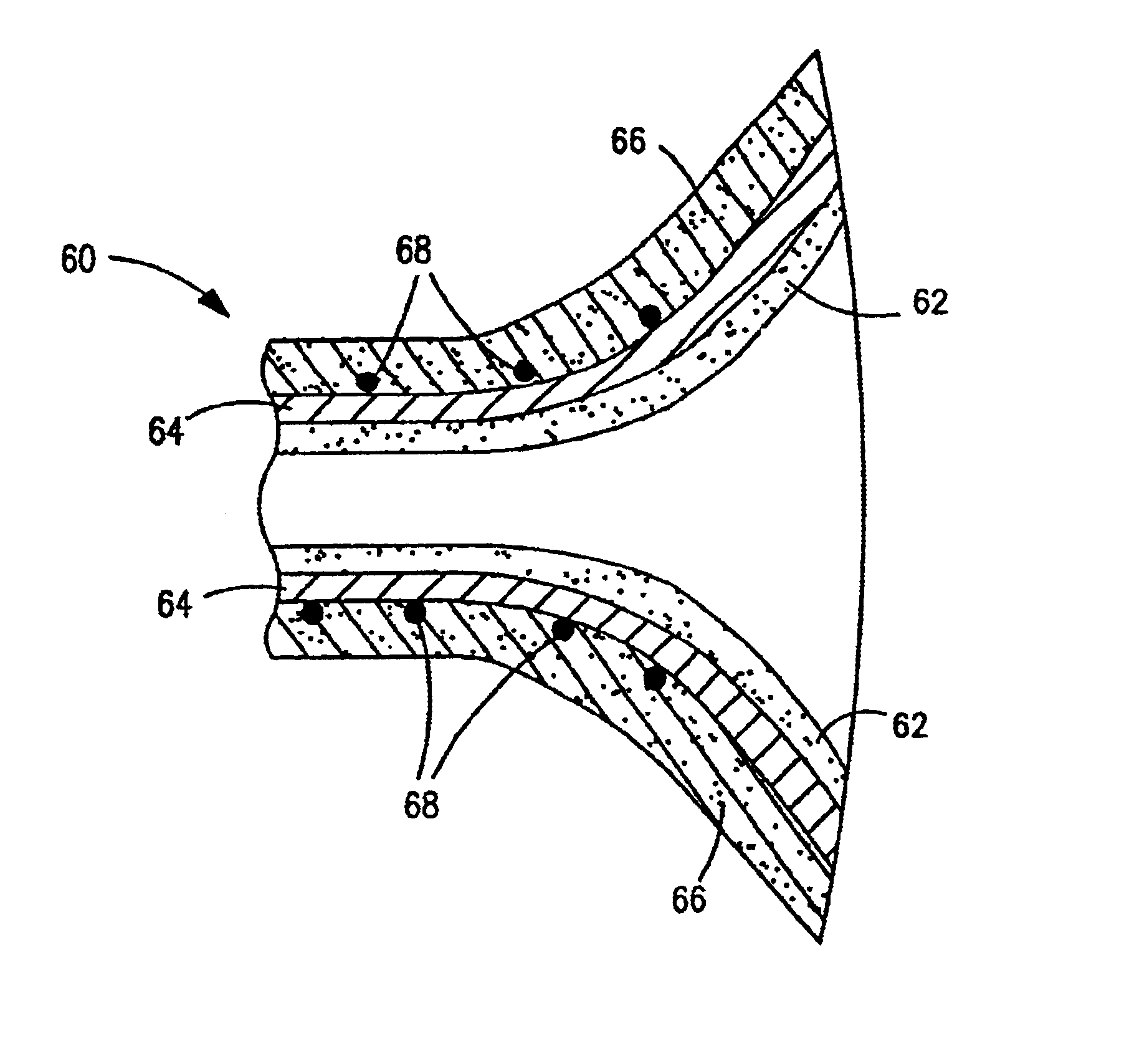 Flared coronary artery bypass grafts