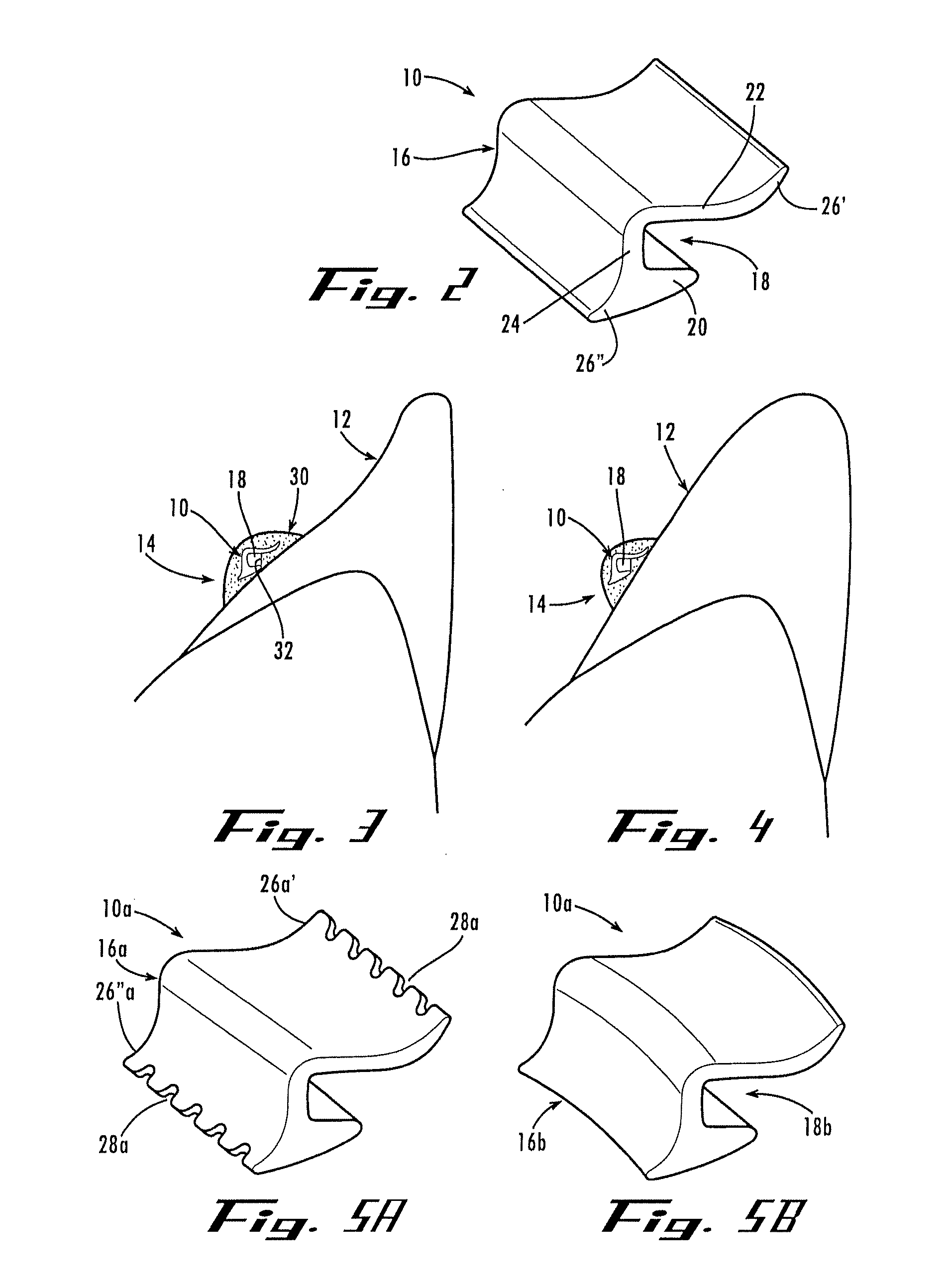 Orthodontic bracket and method of attaching orthodontic brackets to teeth