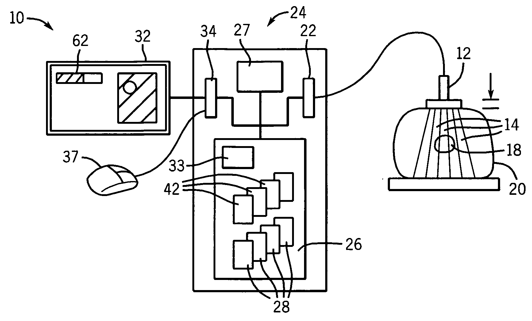 Automated ultrasonic elasticity image formation with quality measure