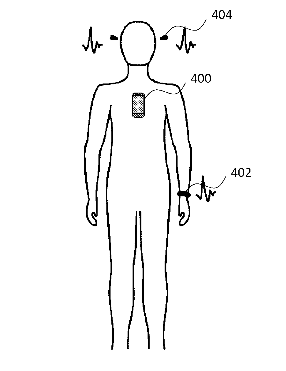 Heart monitoring system