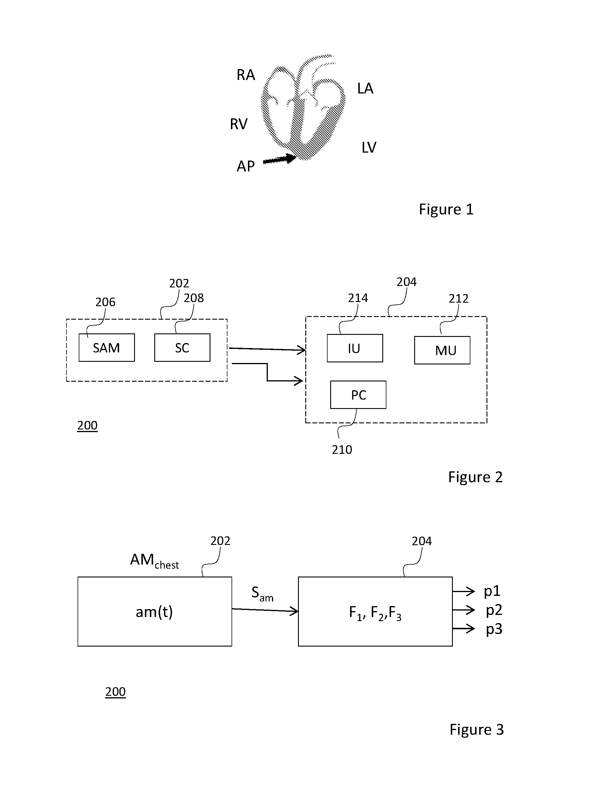 Heart monitoring system