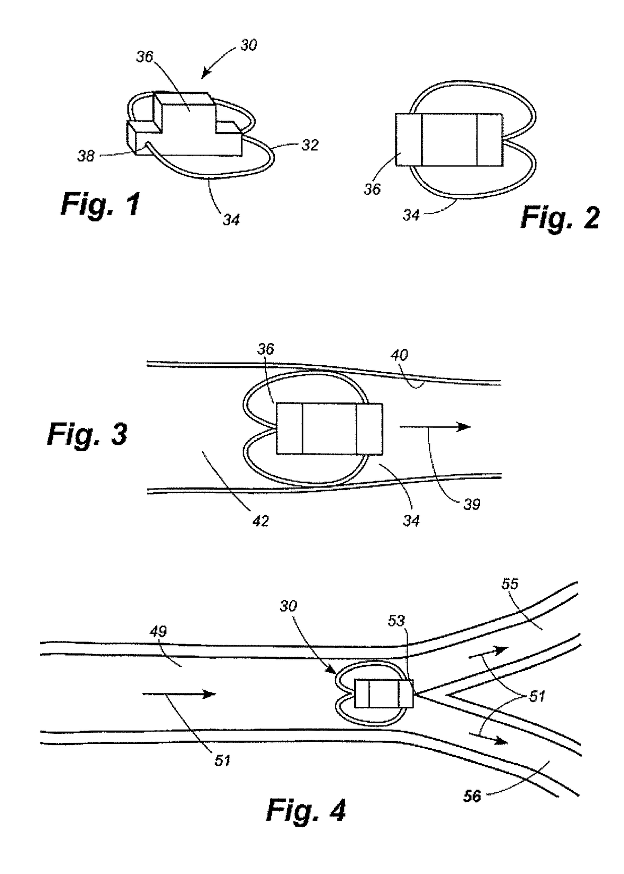 Apparatus and method for sensor deployment and fixation