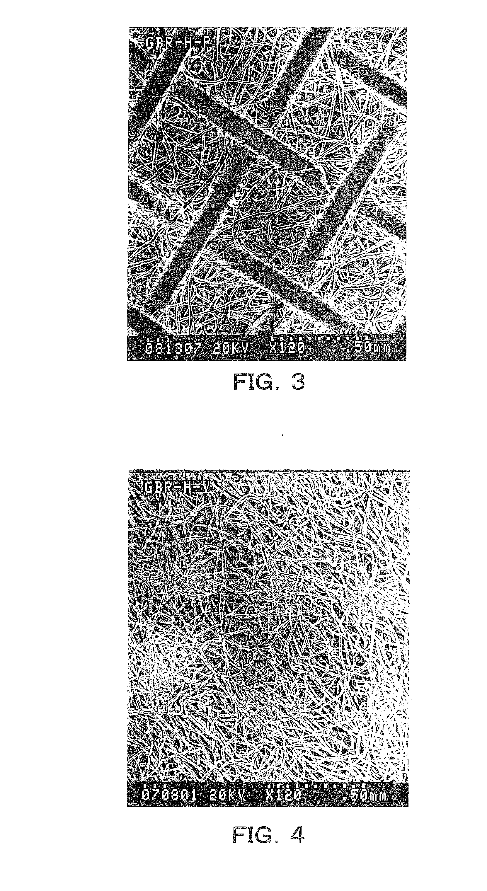 Guided bone regeneration membrane and manufacturing method thereof
