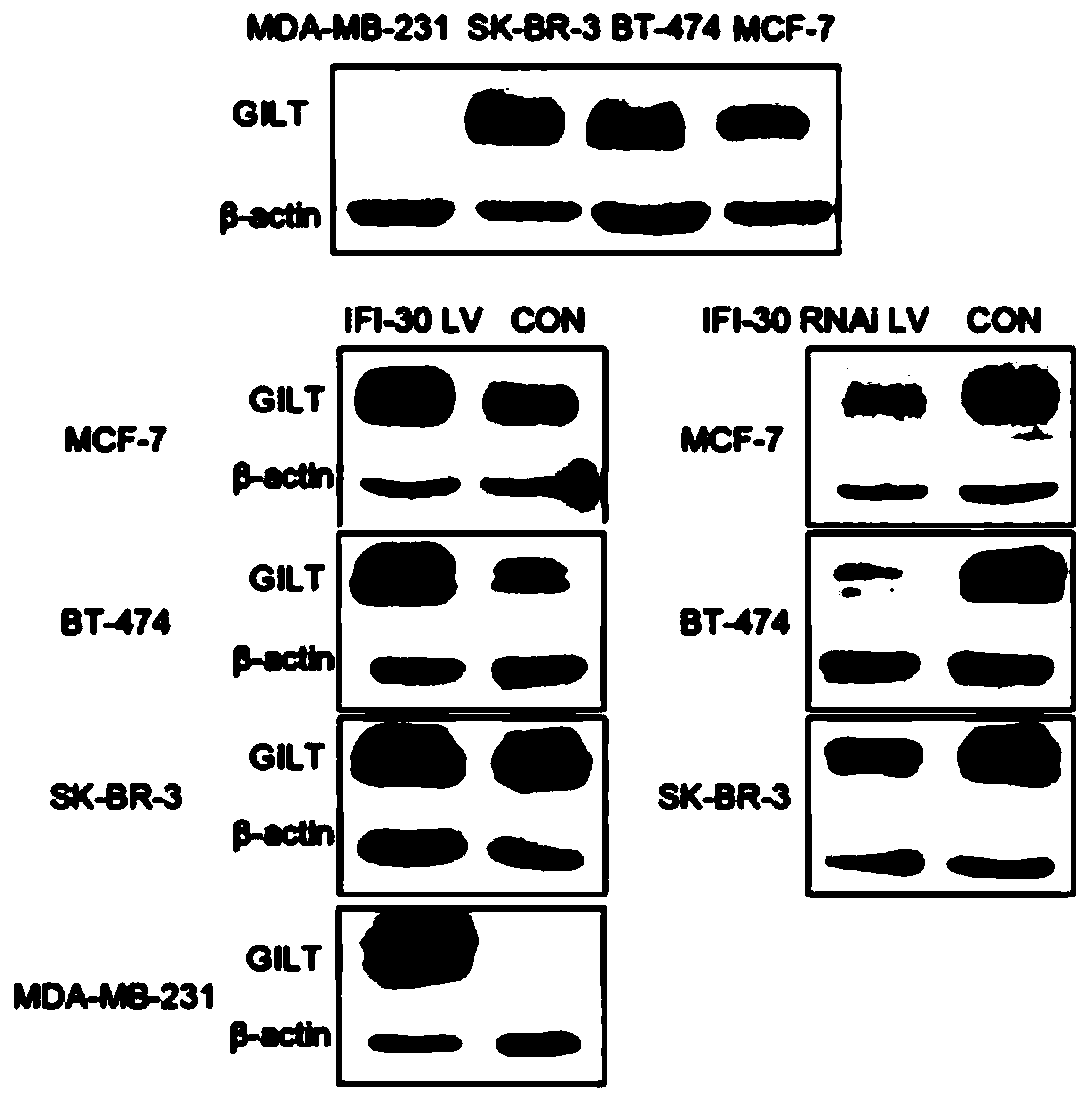 Application of protein/gene IFI30 related to breast cancer occurrence and development