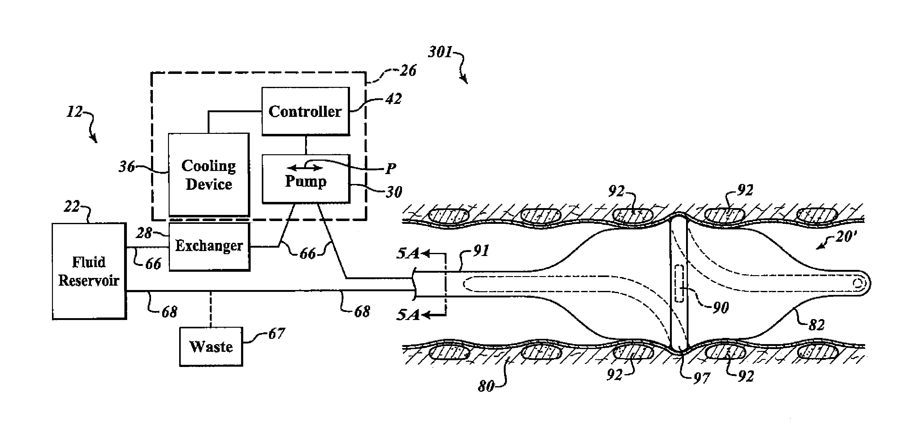 Fluid delivery system and method for treatment