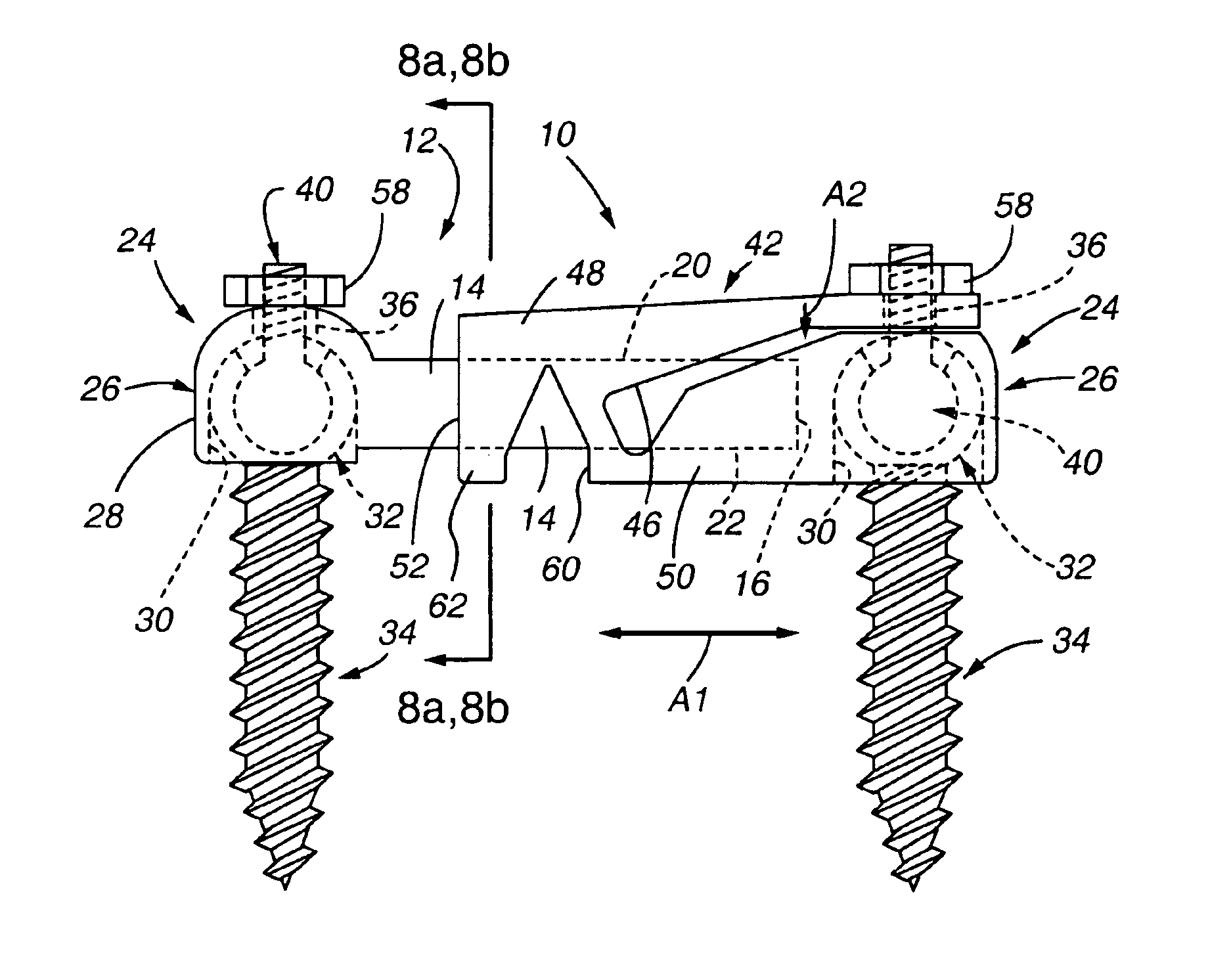 Adjustable rod and connector device and method of use