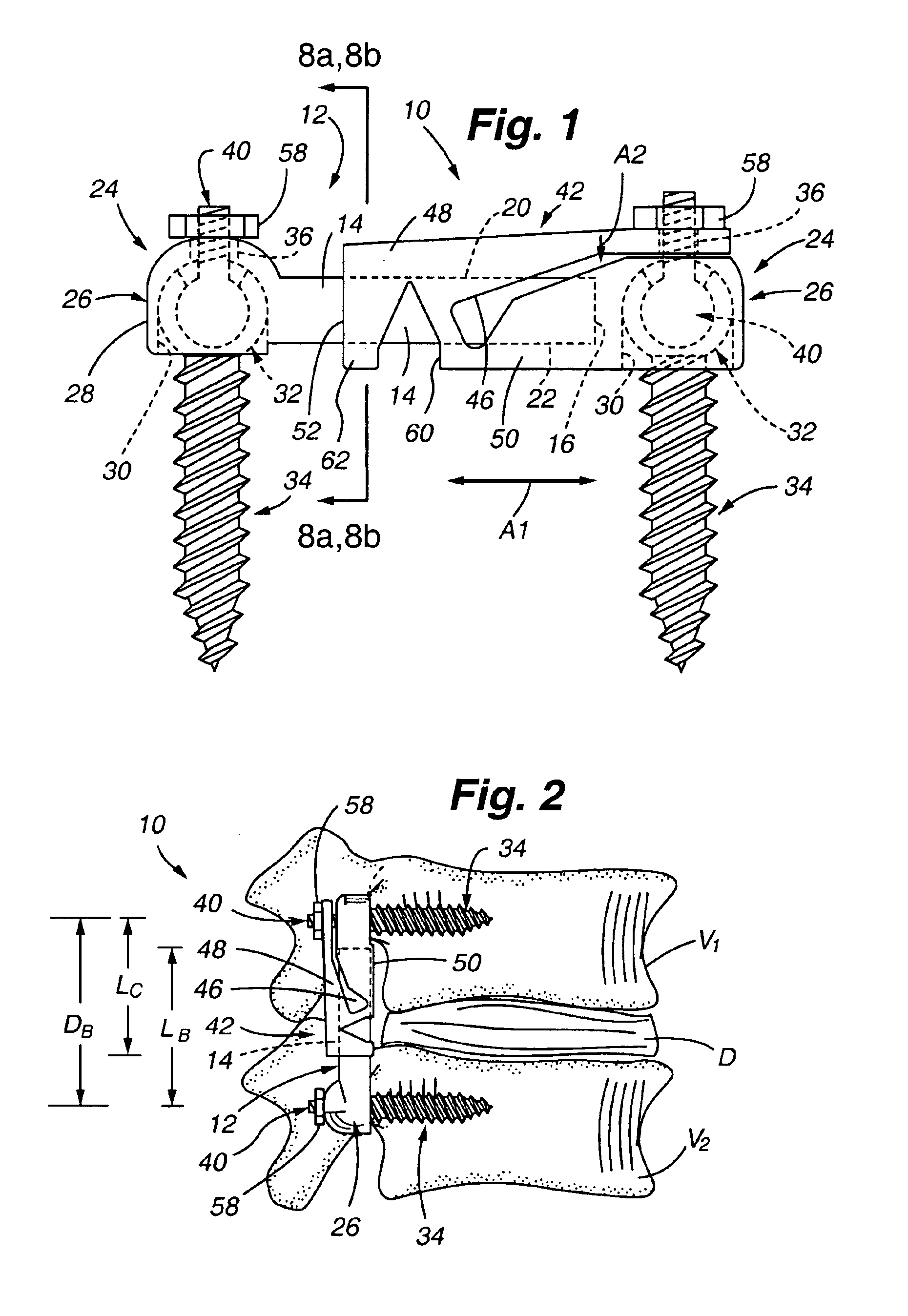 Adjustable rod and connector device and method of use