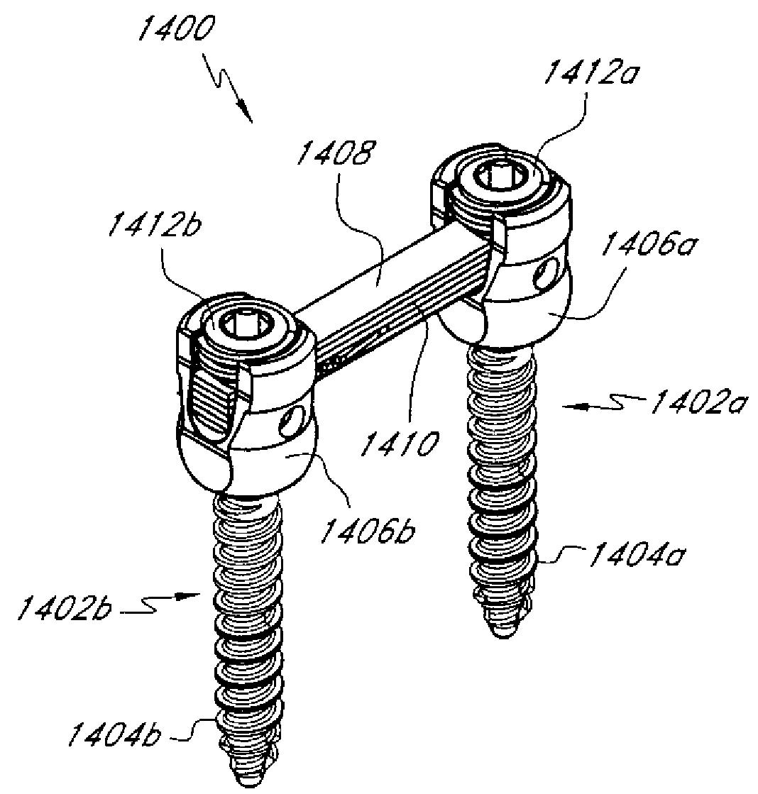 Methods and apparatuses for stabilizing the spine through an access device