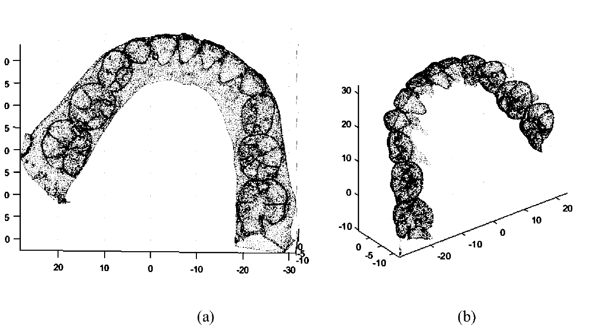 Tooth occlusion analysis system based on point cloud spatial characteristics