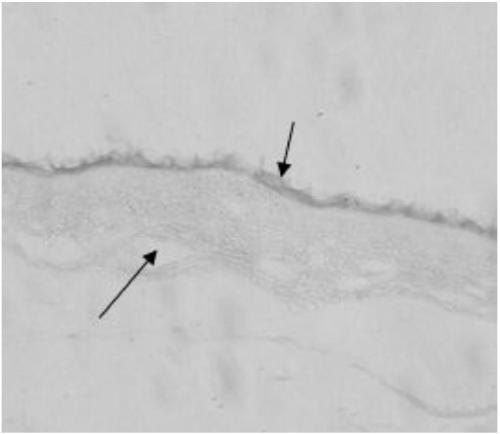 A preparation method and application of decellularized amniotic membrane for skin refractory wound repair