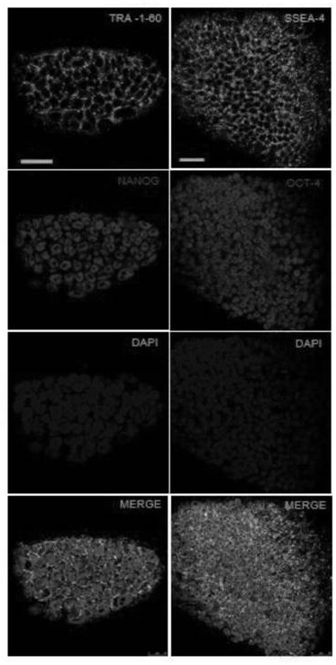 GPD1L-deleted human embryonic stem cell strain and construction method and application thereof