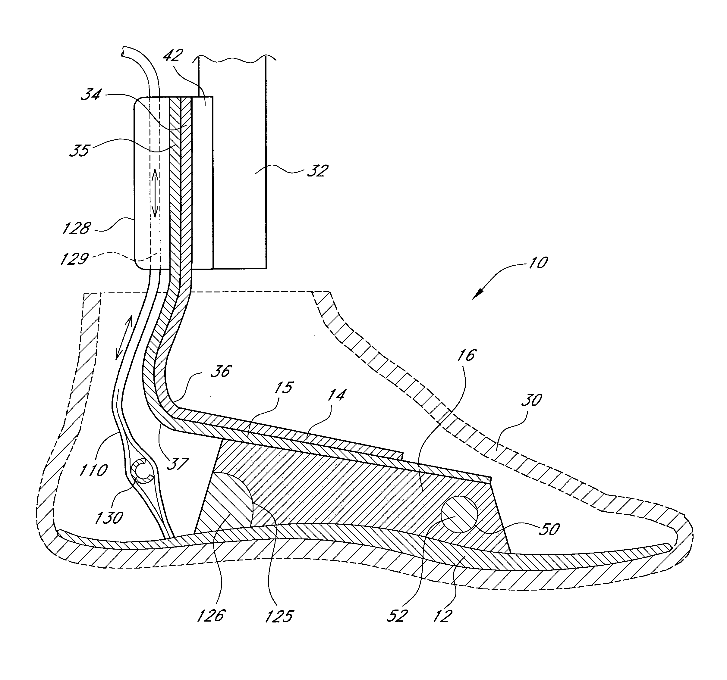 Foot prosthesis having cushioned ankle