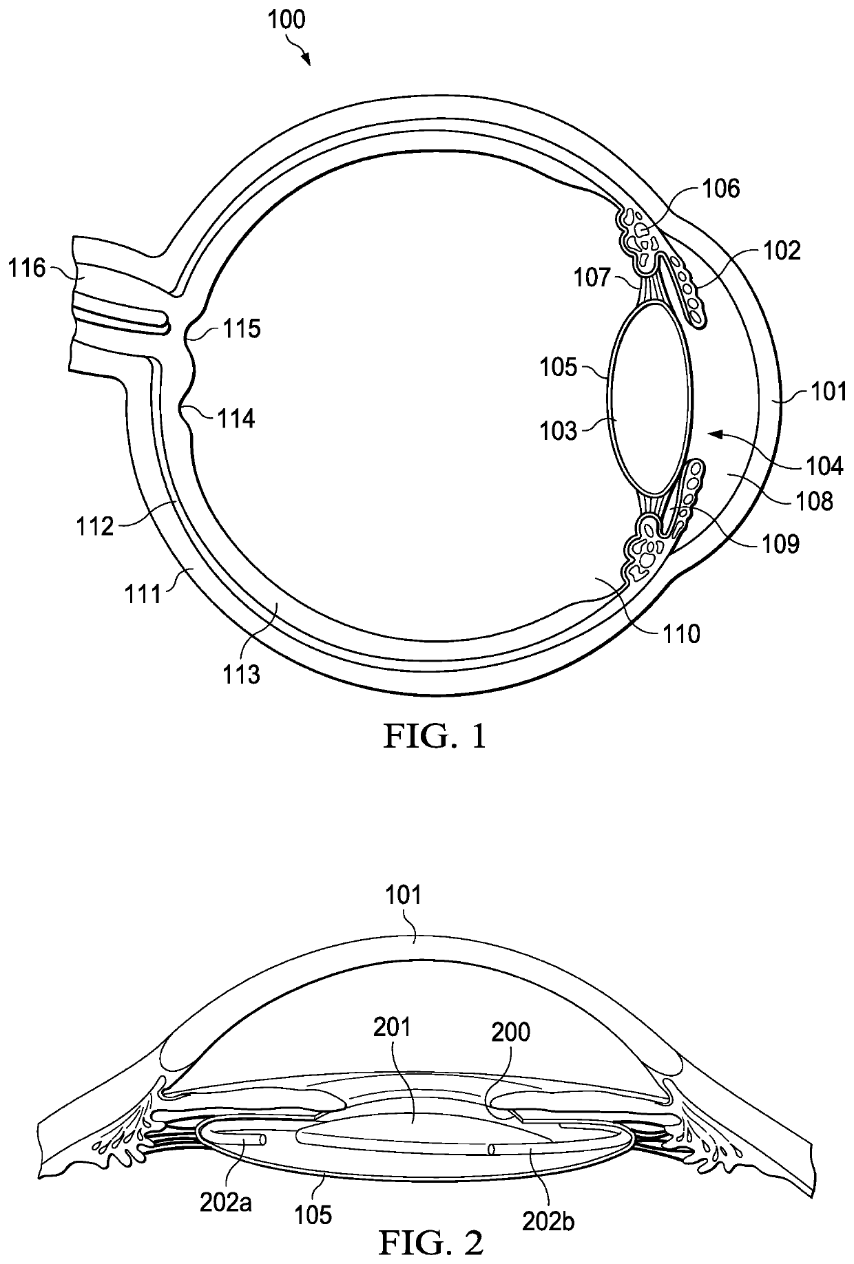 Vision correction systems and methods for using an intraocular lens enclosed in an inner capsulated bag