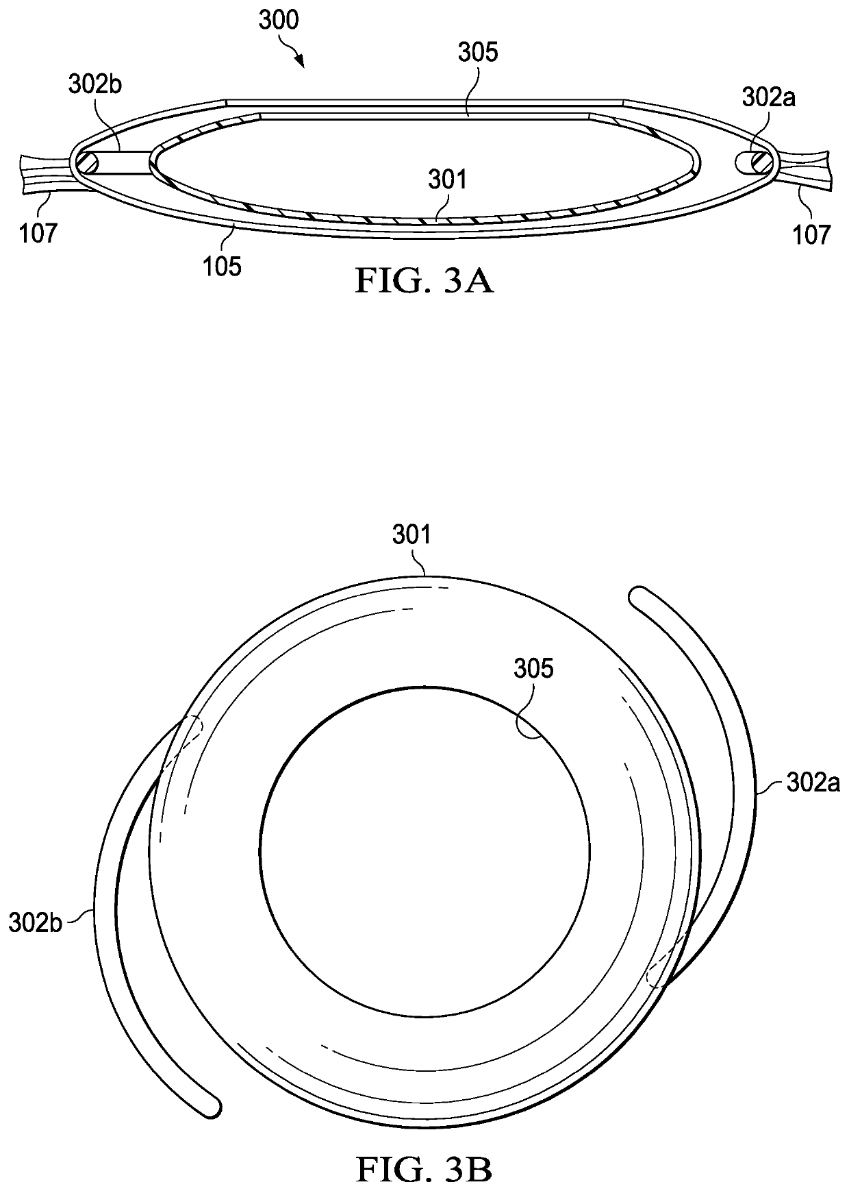 Vision correction systems and methods for using an intraocular lens enclosed in an inner capsulated bag