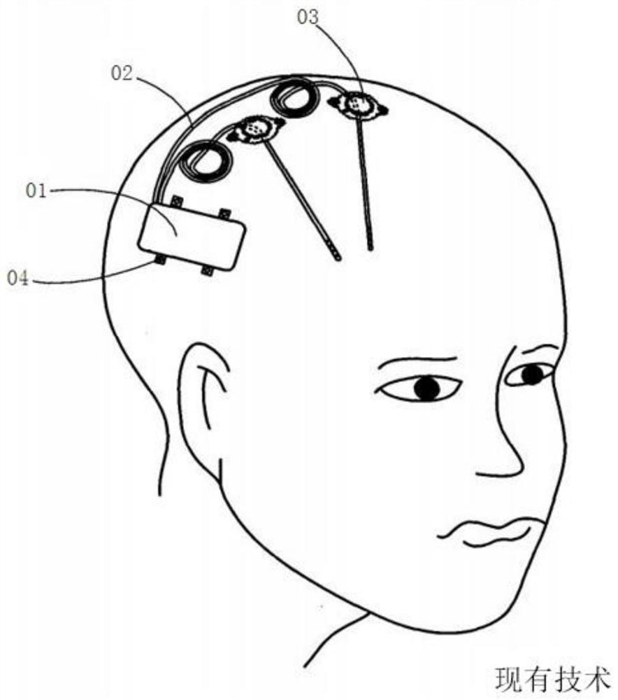 Bendable pulse generator and implantable nerve electrical stimulation system