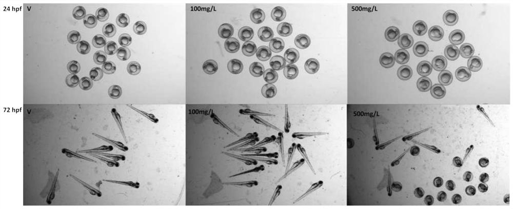 Application of olive leaf extract in the preparation of drugs for the prevention and treatment of fetal alcohol syndrome