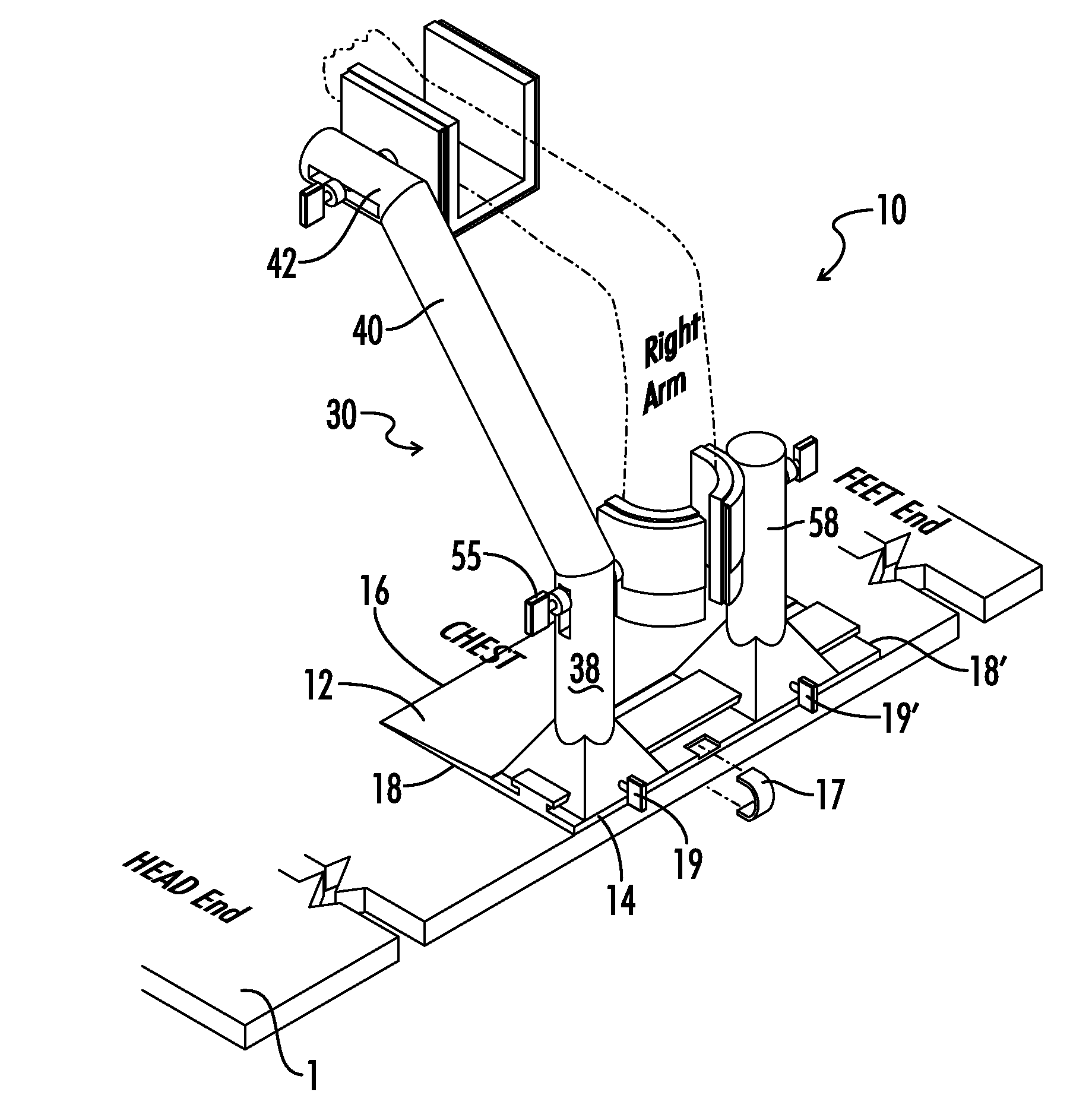 Arm stabilizer for elbow surgical procedure