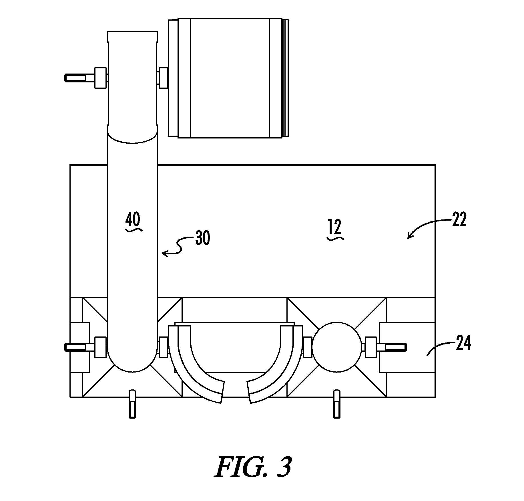 Arm stabilizer for elbow surgical procedure