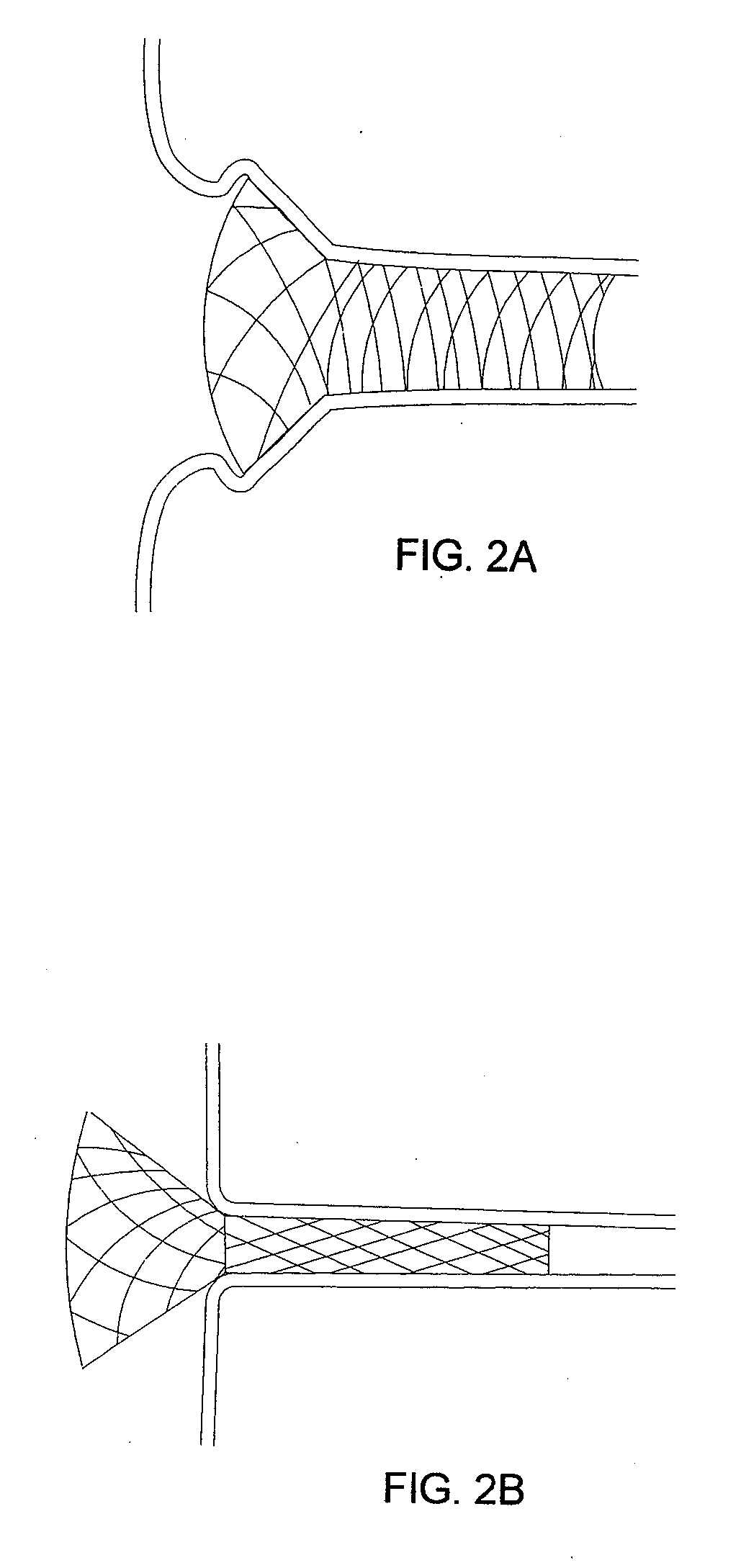 Axially compressible flared stents and apparatus and methods for delivering them